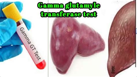 ggtp blood test
